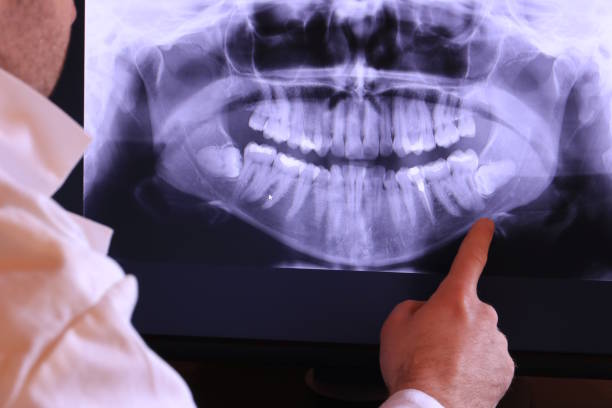 Best Emergency Gum Treatment in Ray City, GA