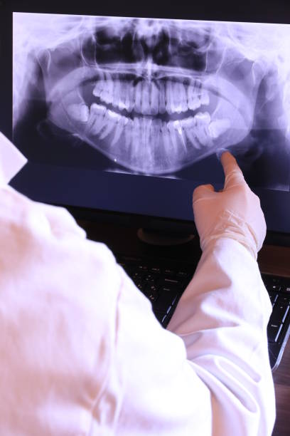 Best Emergency Treatment for Dental Infections or Abscesses in Ray City, GA